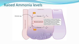 Raised Ammonia levels
 