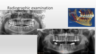 Radiographic examination
 
