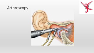 Arthroscopy
 
