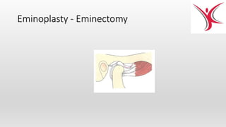 Eminoplasty - Eminectomy
 