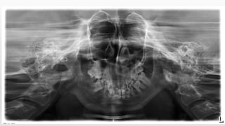 1/7/2018 case presentation / jaya lakshmi / 12 55
 