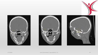 1/7/2018 case presentation / jaya lakshmi / 12 56
 