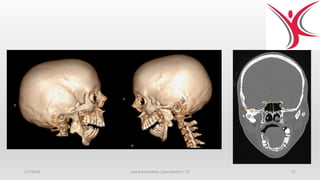 1/7/2018 case presentation / jaya lakshmi / 12 57
 