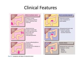 Clinical Features
 