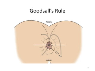 Goodsall’s Rule
83
 