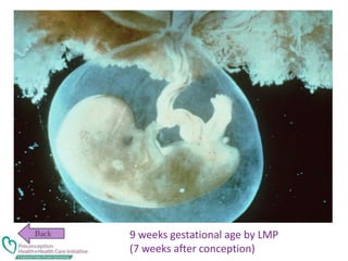 9 weeks gestational age by LMP
(7 weeks after conception)
 
