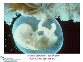 9 weeks gestational age by LMP
(7 weeks after conception)
 