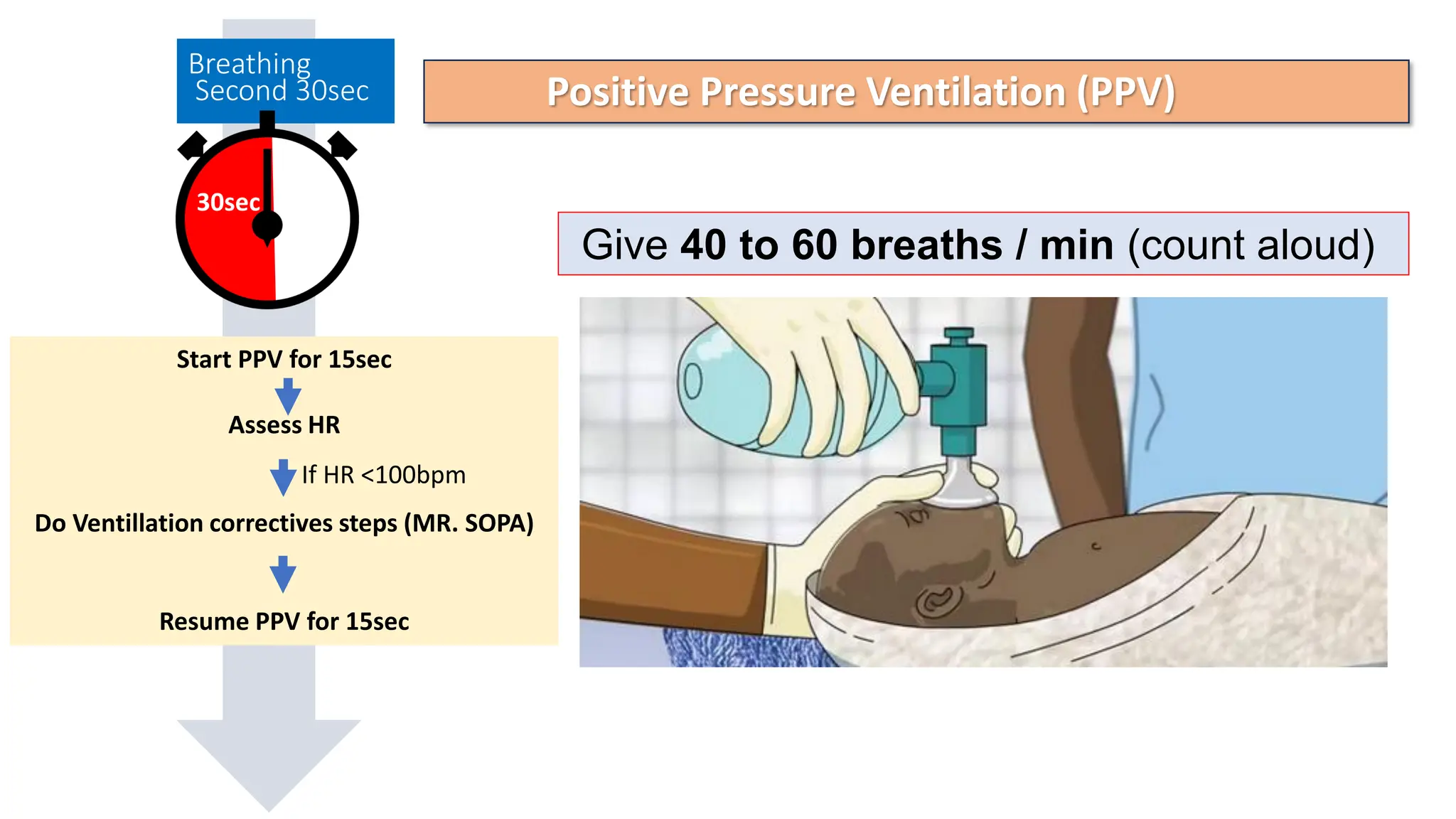 Neonatal Resuscitation by Dr Gabriel 2023 | PDF