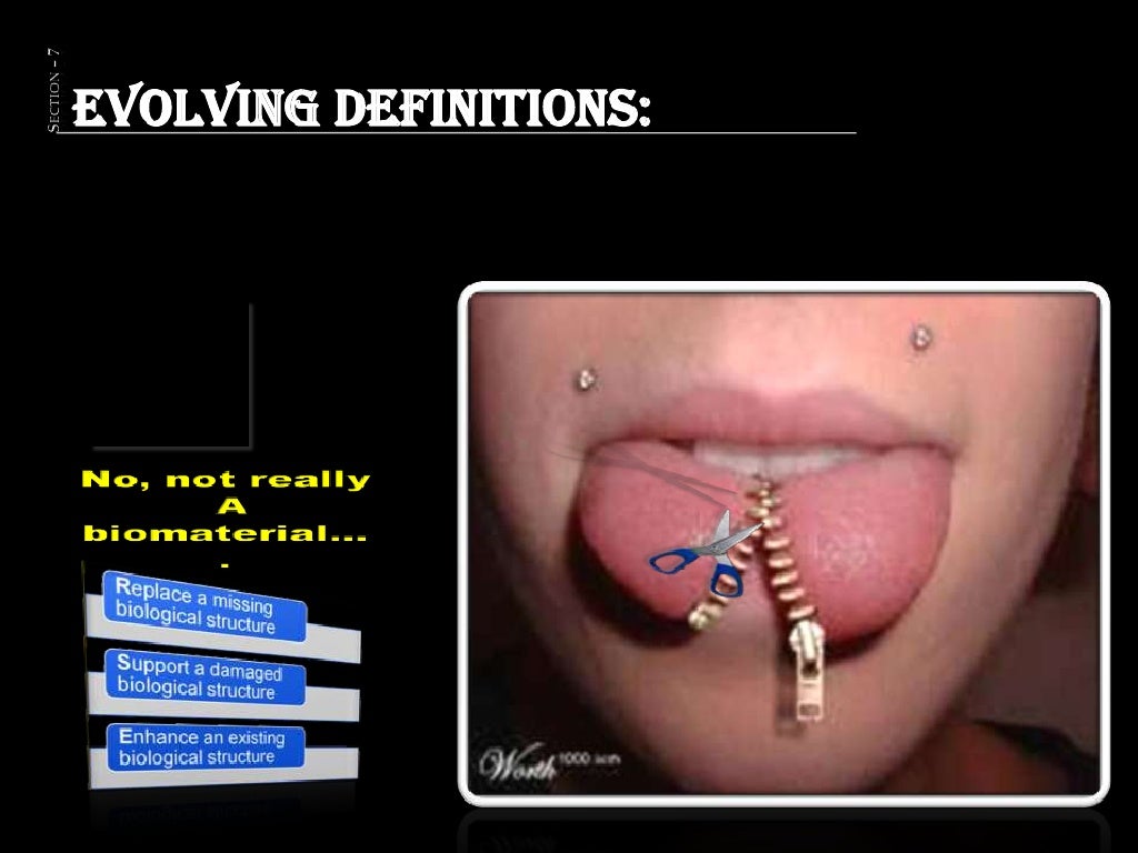 Basics of HUMAN BIOMATERIALS, IMPLANTABLE MEDICAL DEVICES AND BIOMED…