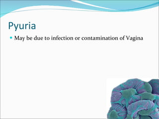 Pyuria Pregnancy Pregnancy and Renal Disease | PPT