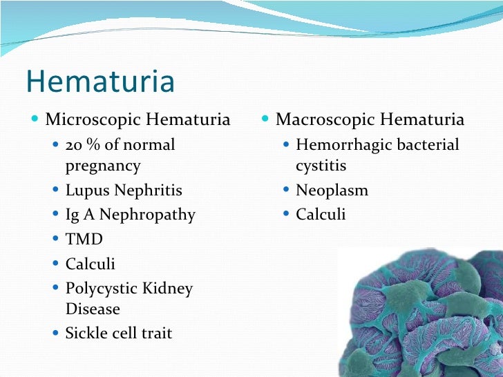 Pregnancy and Renal Disease