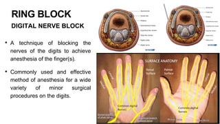 CME PERIPHERAL BLOCK.pptx