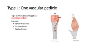 Pedicle Flaps Example Basic Principles of Flap | PDF