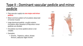 Pedicle Flaps Example Basic Principles of Flap | PDF