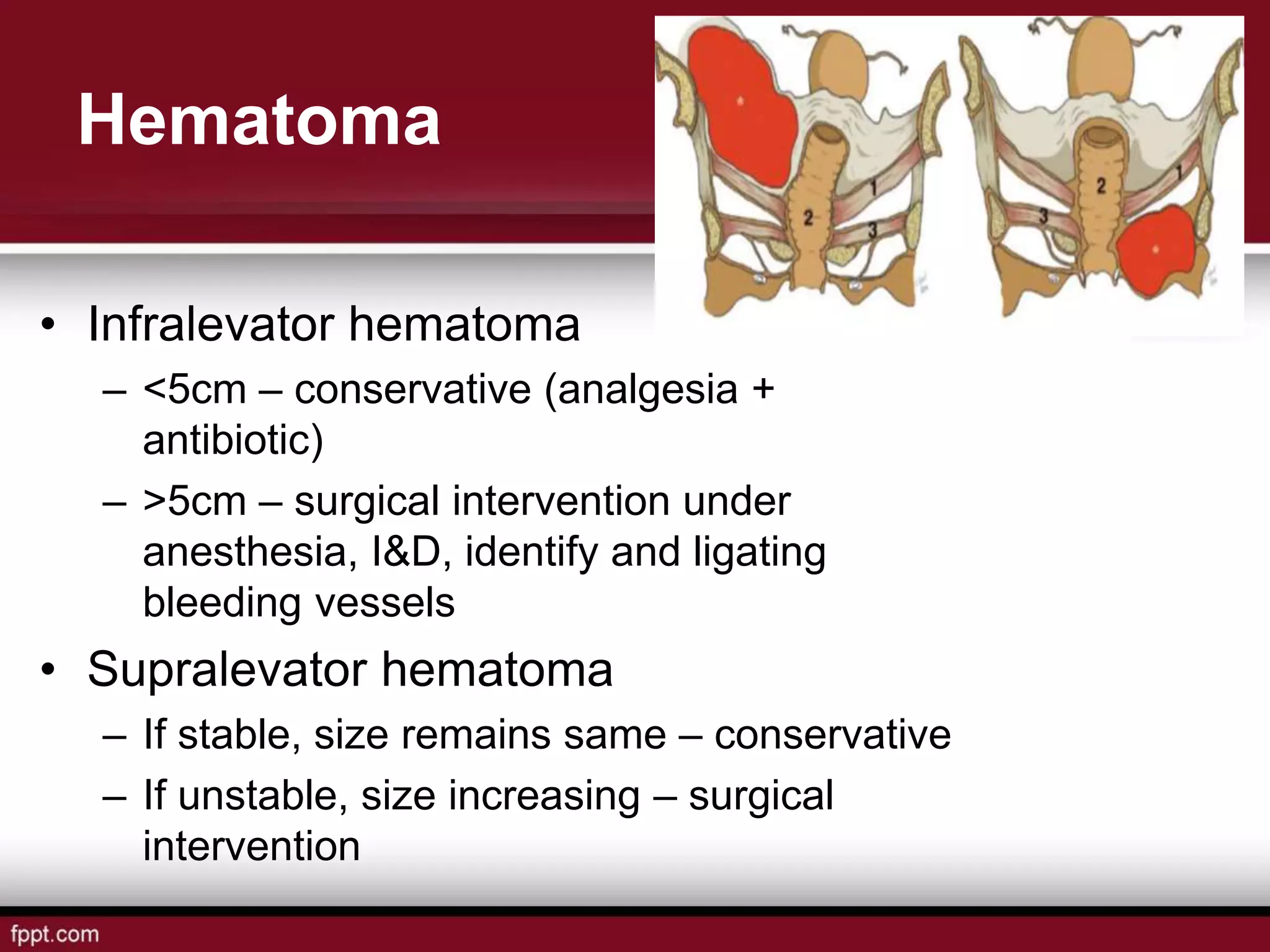 Hematoma
• Infralevator hematoma
– <5cm – conservative (analgesia +
antibiotic)
– >5cm – surgical intervention under
anesthesia, I&D, identify and ligating
bleeding vessels
• Supralevator hematoma
– If stable, size remains same – conservative
– If unstable, size increasing – surgical
intervention
 