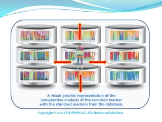 A visual graphic representation of the
comparative analysis of the recorded marker
with the standard markers from the database.

Copyright © 2012 CME SWISS AG. Alle Rechte vorbehalten.
 
