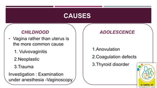 CHILDHOOD
• Vagina rather than uterus is
the more common cause
1. Vulvovaginitis
2.Neoplastic
3.Trauma
Investigation : Examination
under anesthesia -Vaginoscopy
1.Anovulation
2.Coagulation defects
3.Thyroid disorder
ADOLESCENCE
CAUSES
 