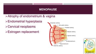 MENOPAUSE
Atrophy of endometrium & vagina
Endometrial hyperplasia
Cervical neoplasms
Estrogen replacement
 