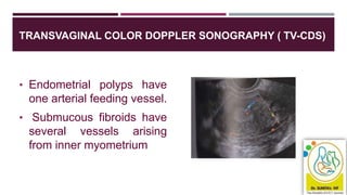 TRANSVAGINAL COLOR DOPPLER SONOGRAPHY ( TV-CDS)
• Endometrial polyps have
one arterial feeding vessel.
• Submucous fibroids have
several vessels arising
from inner myometrium
 