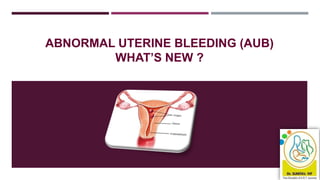 ABNORMAL UTERINE BLEEDING (AUB)
WHAT’S NEW ?
 