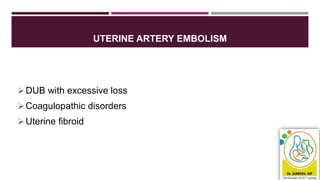 UTERINE ARTERY EMBOLISM
DUB with excessive loss
Coagulopathic disorders
Uterine fibroid
 