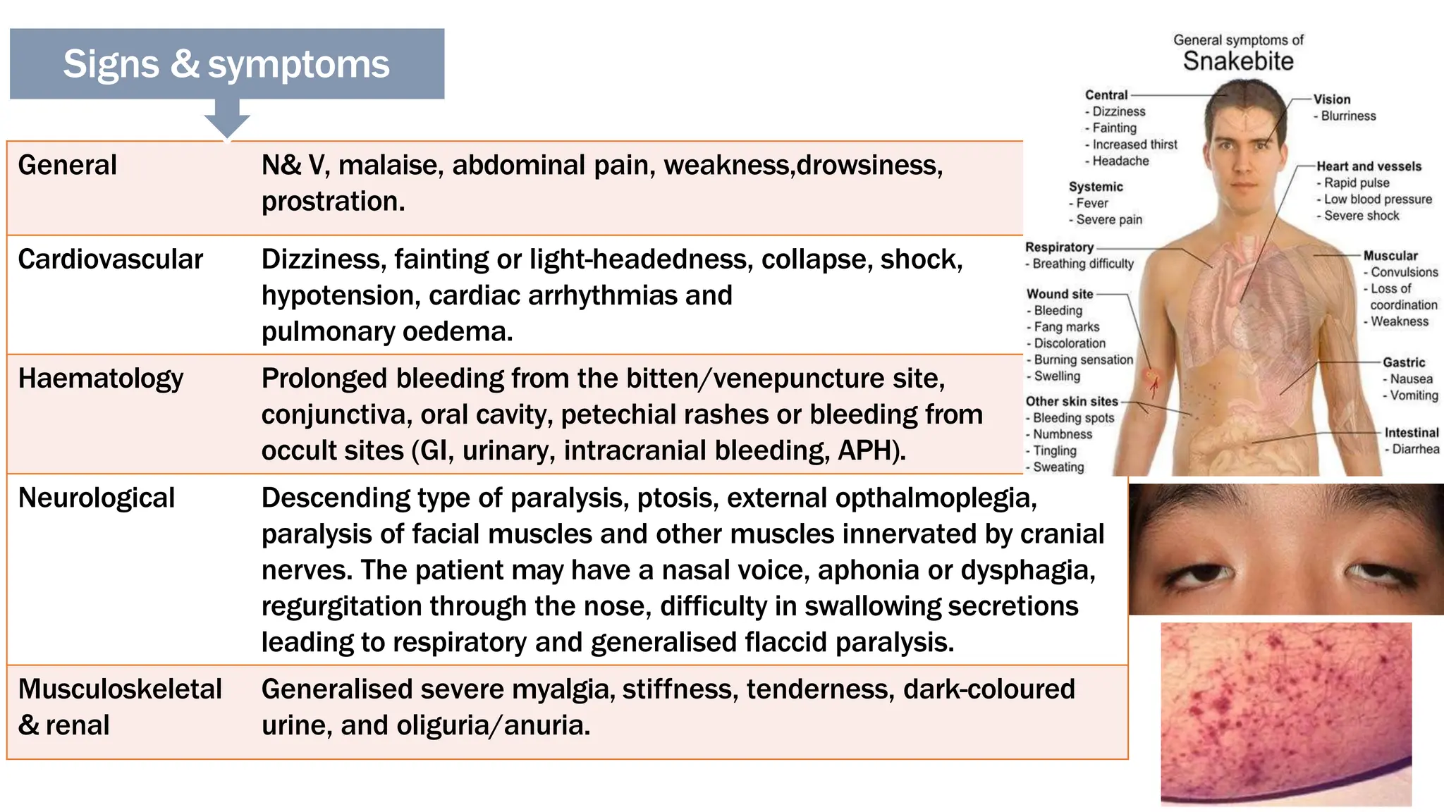 CME Snake Bite.pptx snake bite snake bite | PPTX
