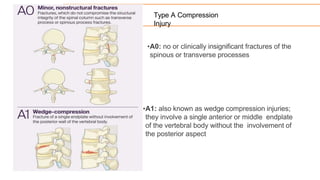 Compression
fracture
• Non operative
– Observation, bracing and medical
management
• PLL intact even if >30 degrees kyphos...