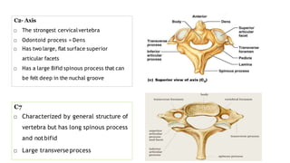 C2- Axis
□ The strongest cervicalvertebra
□ Odontoid process = Dens
□ Has two large, flat surface superior
articular facet...