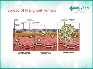 Basics of surgical oncology and pathophysiology of cancer.pptx