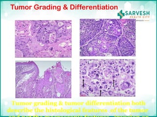 Basics of surgical oncology and pathophysiology of cancer.pptx
