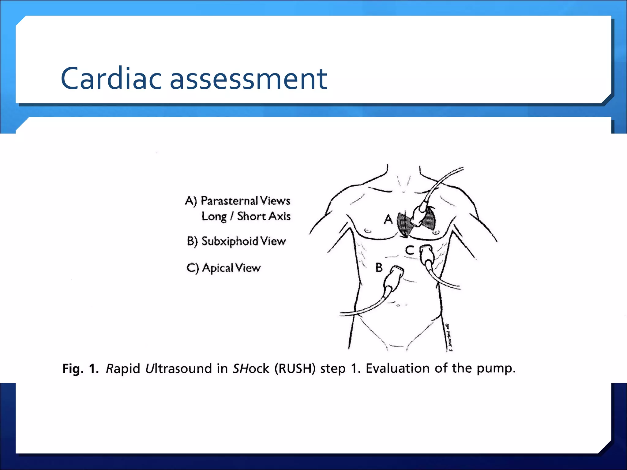 Cardiac assessment

 