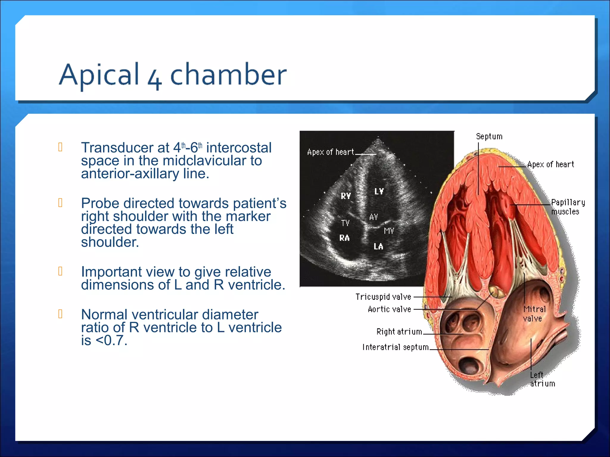 

Transducer at 4th-6th intercostal
space in the midclavicular to
anterior-axillary line.



Probe directed towards patient’s
right shoulder with the marker
directed towards the left
shoulder.



Important view to give relative
dimensions of L and R ventricle.



Normal ventricular diameter
ratio of R ventricle to L ventricle
is <0.7.

 