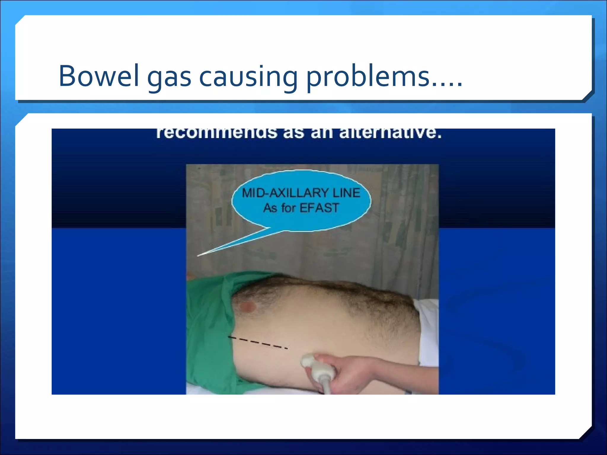 Bowel gas causing problems….

 