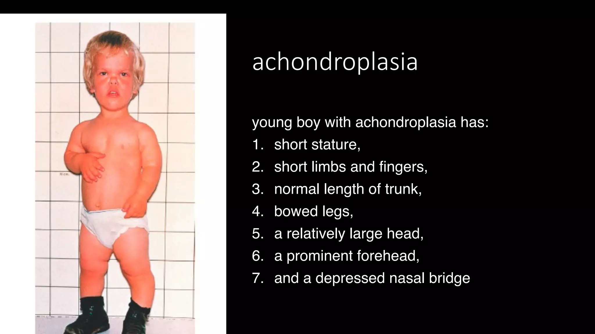 Human Birth Defects and Common congenital anomalies | PDF