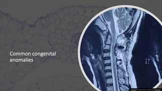 Common congenital
anomalies
This Photo by Unknown author is licensed under CC BY-SA-NC.
 