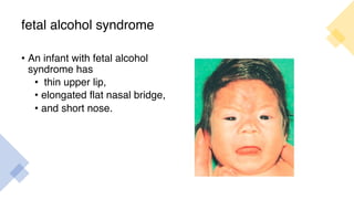 fetal alcohol syndrome
• An infant with fetal alcohol
syndrome has
• thin upper lip,
• elongated flat nasal bridge,
• and short nose.
 