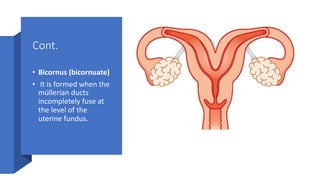 Cont.
• Bicornus (bicornuate)
• It is formed when the
müllerian ducts
incompletely fuse at
the level of the
uterine fundus.
 