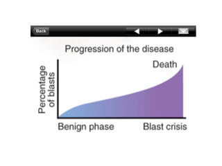 Chronic Myeloid Leukemia | PPTX