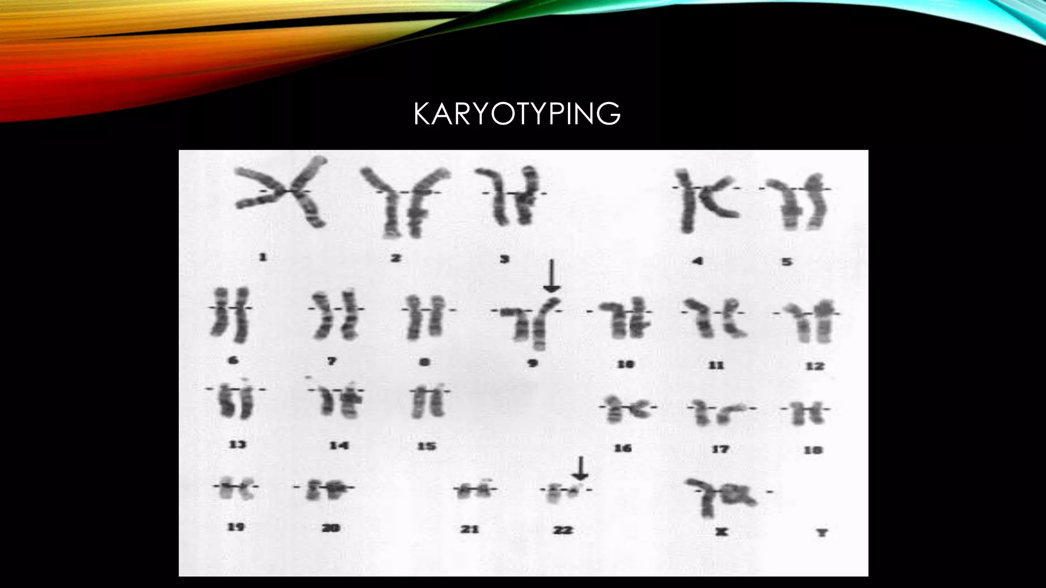 KARYOTYPING

 