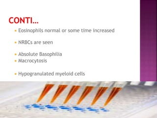  Eosinophils normal or some time increased
 NRBCs are seen
 Absolute Basophilia
 Macrocytosis
 Hypogranulated myeloid cells
 