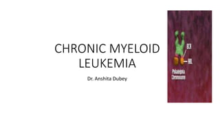 CHRONIC MYELOID
LEUKEMIA
Dr. Anshita Dubey
 