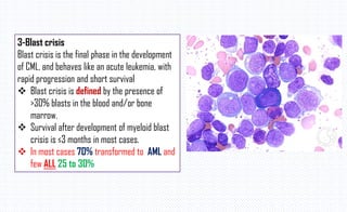 3-Blast crisis
Blast crisis is the final phase in the development
of CML, and behaves like an acute leukemia, with
rapid progression and short survival
 Blast crisis is defined by the presence of
>30% blasts in the blood and/or bone
marrow.
 Survival after development of myeloid blast
crisis is ≤3 months in most cases.
 In most cases 70% transformed to AML and
few ALL 25 to 30%
 