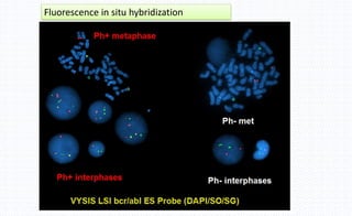 Fluorescence in situ hybridization
 