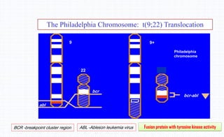The Philadelphia Chromosome: t(9;22) Translocation
bcr-abl
Fusion protein with tyrosine kinase activity
22
bcr
abl
Ph
9 9+
Philadelphia
chromosome
BCR -breakpoint cluster region ABL -Ableson leukemia virus
 