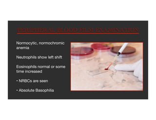 CML.PPT,CHRONIC MYELOID LEUKEMIA:HEMATOLOGY | PDF