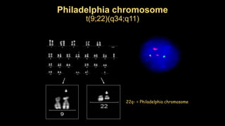 Philadelphia chromosome
t(9;22)(q34;q11)
22q- = Philadelphia chromosome
 