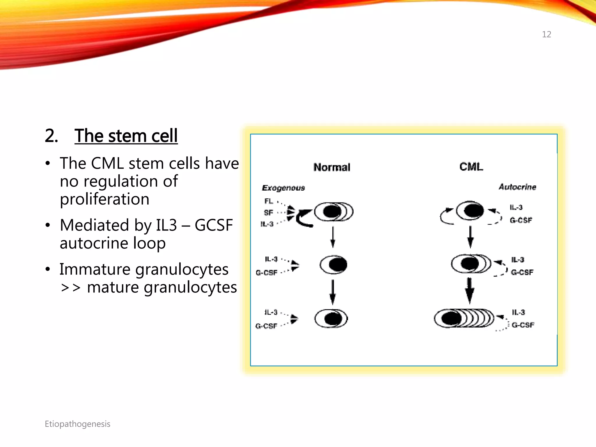 2. The stem cell
• The CML stem cells have
no regulation of
proliferation
• Mediated by IL3 – GCSF
autocrine loop
• Immature granulocytes
>> mature granulocytes
Etiopathogenesis
12
 