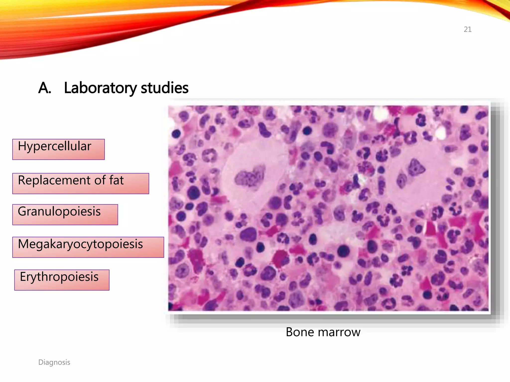 A. Laboratory studies
Diagnosis
21
Bone marrow
Hypercellular
Replacement of fat
Granulopoiesis
Megakaryocytopoiesis
Erythropoiesis
 