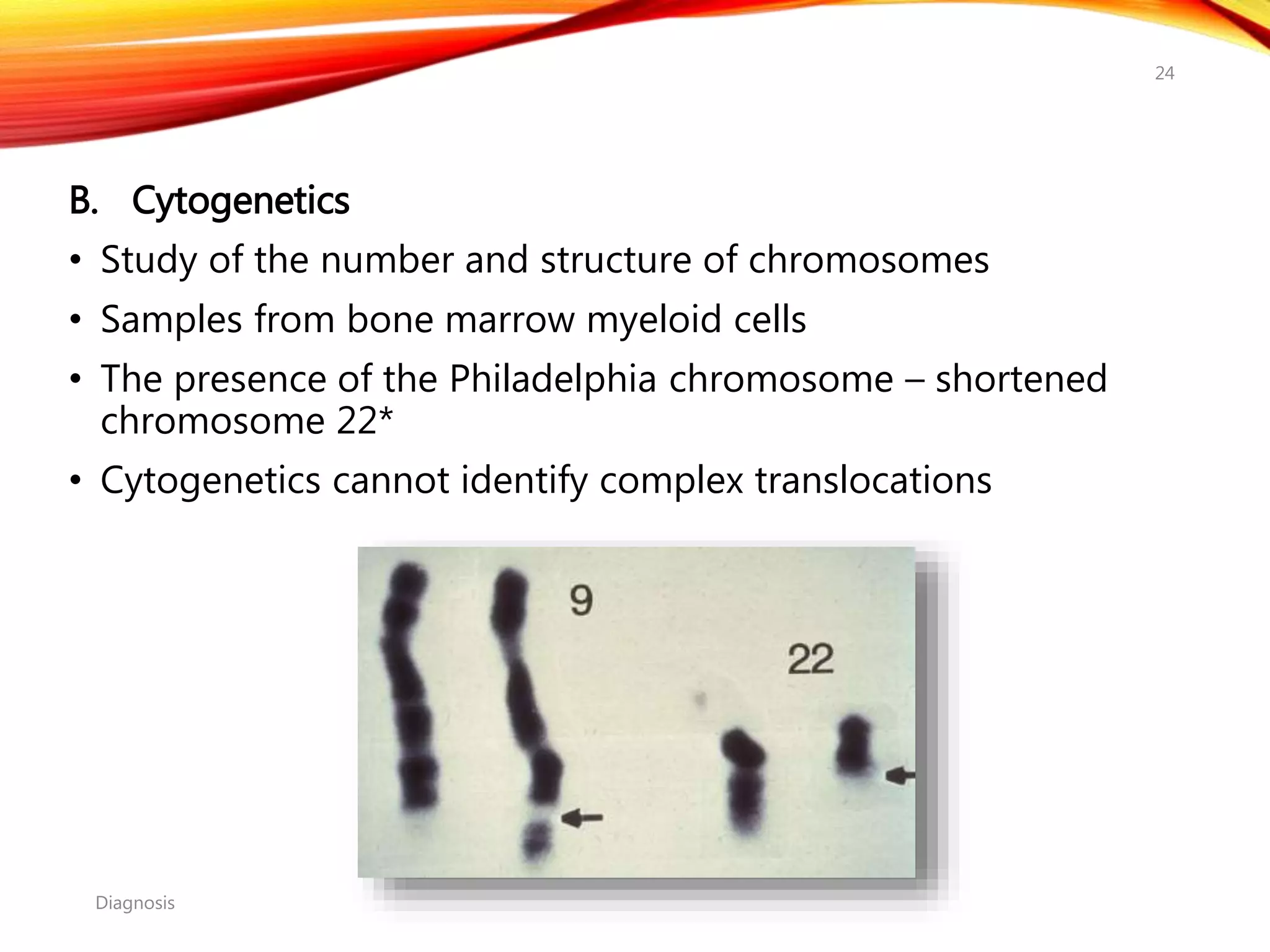 B. Cytogenetics
• Study of the number and structure of chromosomes
• Samples from bone marrow myeloid cells
• The presence of the Philadelphia chromosome – shortened
chromosome 22*
• Cytogenetics cannot identify complex translocations
Diagnosis
24
 