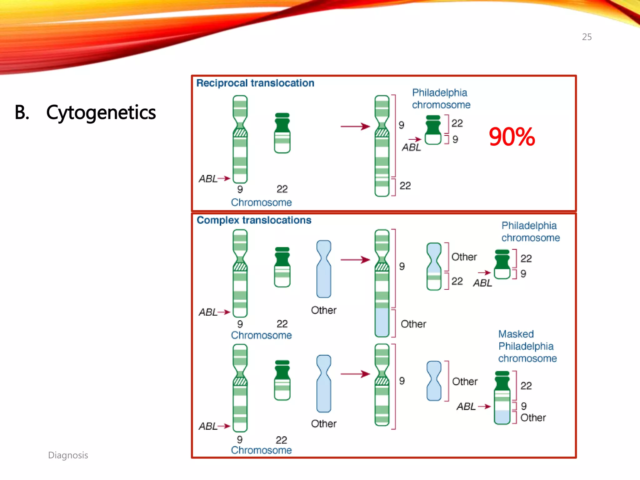 B. Cytogenetics
Diagnosis
25
90%
 